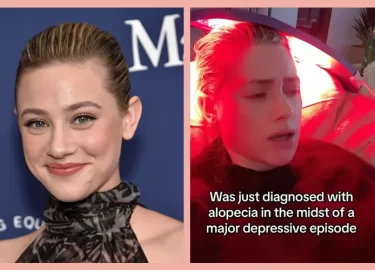 Lili Reinhart’s Red Light Therapy Journey for Depression Healing